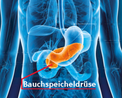 Bauchspeicheldrüsenkrebs - gefährlich, aber behandelbar